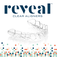 Reveal Clear Aligners Image